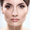 QY208 Blackhead Suction Remover Vacuum Pore Cleaner