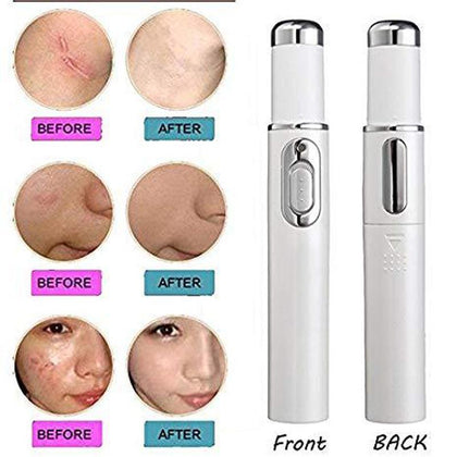 2018 New Medical Blue Light Therapy Laser Treatment Pen Soft Scar Pimple Wrinkle Removal Treatment Device Beauty Skin Care Tools
