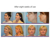 Mini Microcurrent Face Lift Machine Skin Tightening Rejuvenation Spa Usb Charging Facial Wrinkle Remover Device Beauty Massager